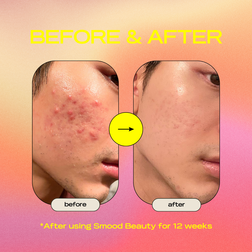 Super Cera Clarifying Barrier Serum
