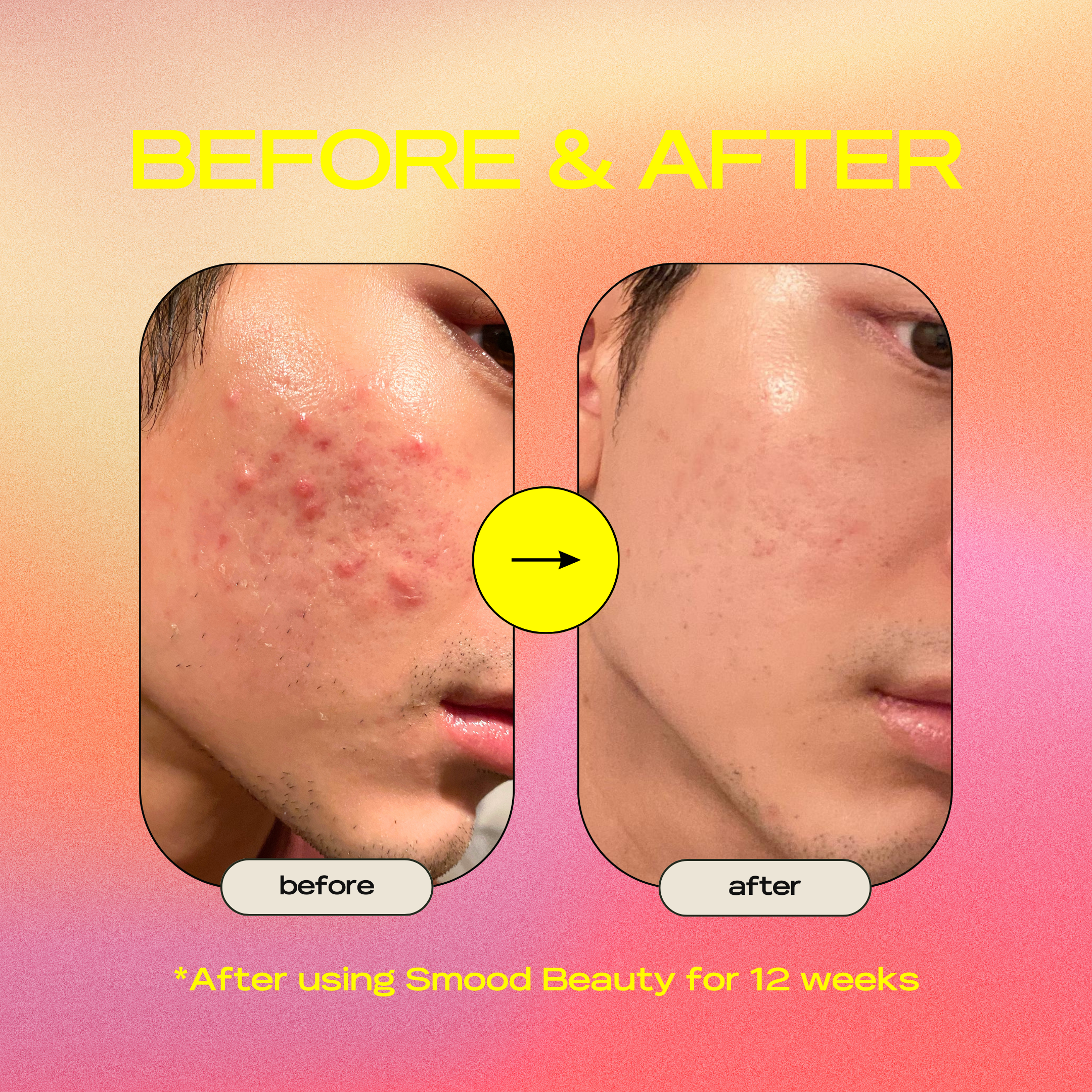 Problem Solver Gel Cream Moisturizer
