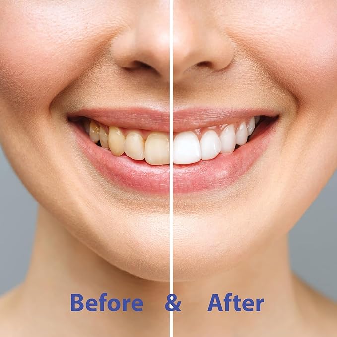 Super Whitening Spearmint NHAP Toothpaste 60 Tablet Refill